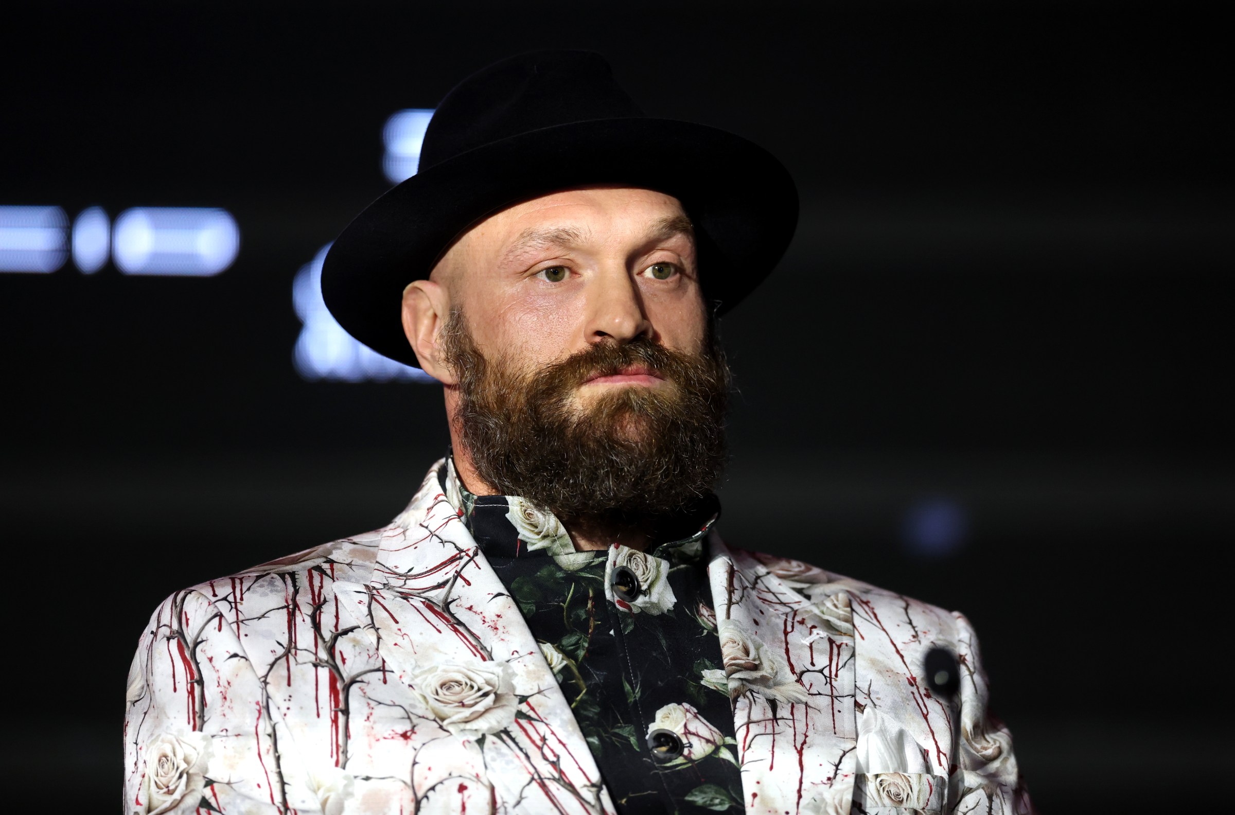 Tyson Fury abierto a una pelea con Wardley, pero hay una condición Tyson Fury abierto a una pelea con Wardley, pero hay una condición