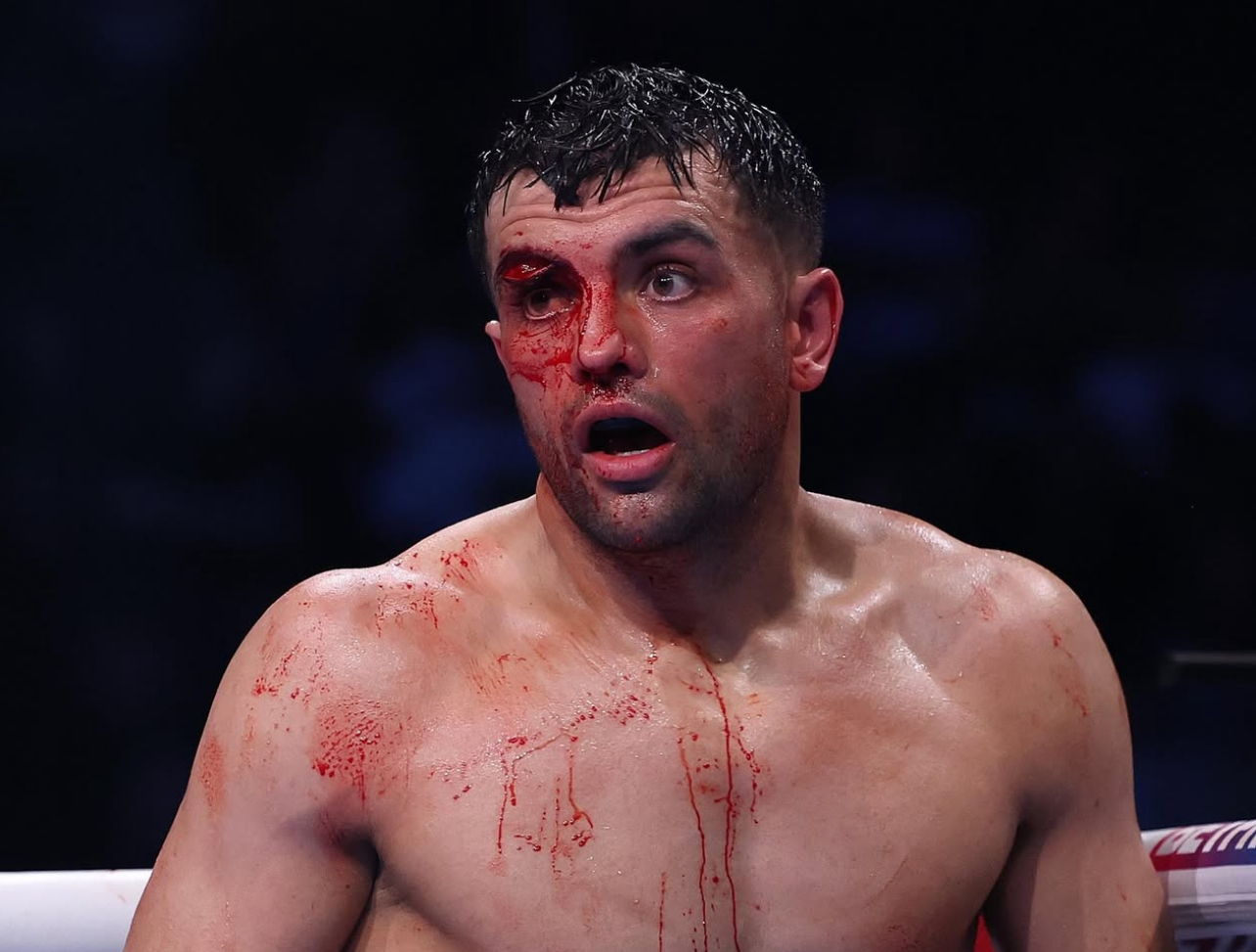 Catterall ganó a Eubank por decisión técnica