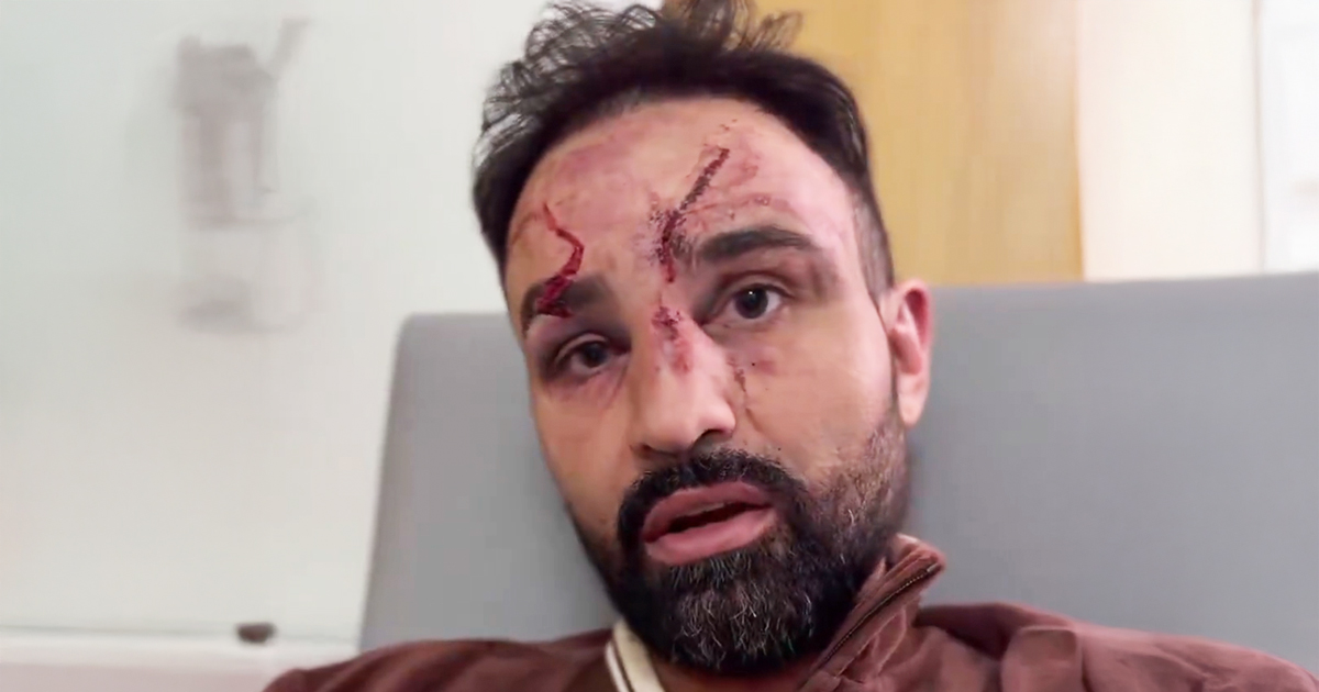 Malignaggi After Bare-Knuckle Win: “I Pray to God There’s No Retinal Tear” Malignaggi After Bare-Knuckle Win: “I Pray to God There’s No Retinal Tear”