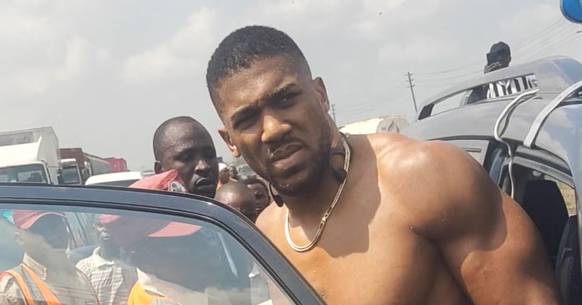 Anthony Joshua fue dado de alta del hospital