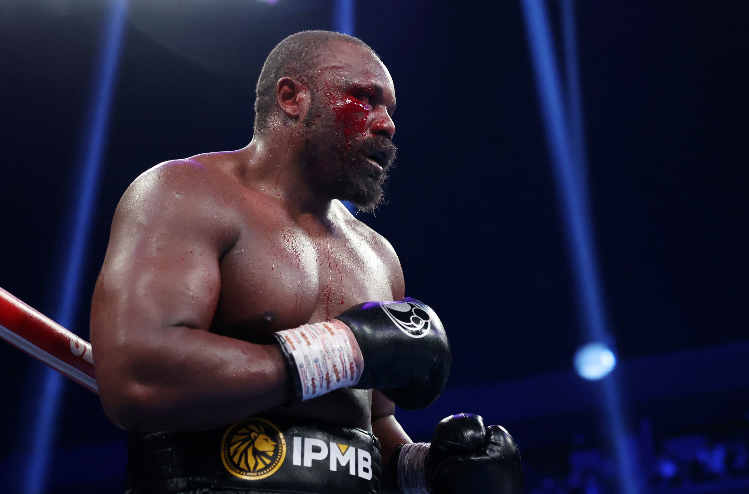 Chisora: “Quise volver a pelear con Whyte porque eso es lo que quiere el público británico”